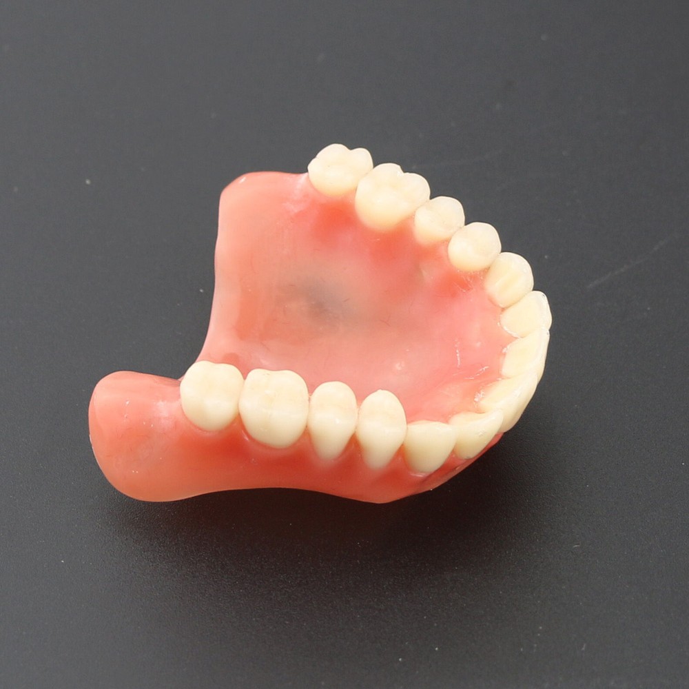 Dental Teeth Model Demo Overdenture Restoration With 4 Implants Upper Maxillary