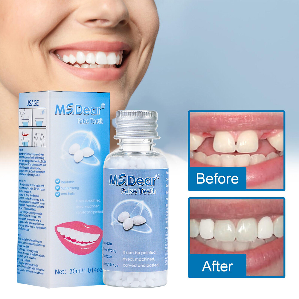 Resin False Teeth Solid Glue Temporary Tooth Repair Moldable Teeth Gap Denture