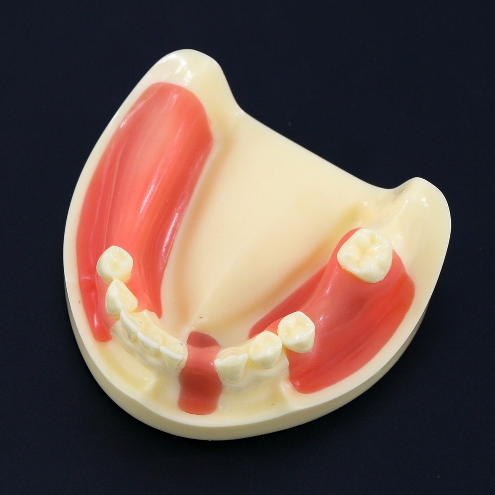 Dental Lower Jaw Implant Drilling Practice Teeth Model Gingiva M2004 Removable