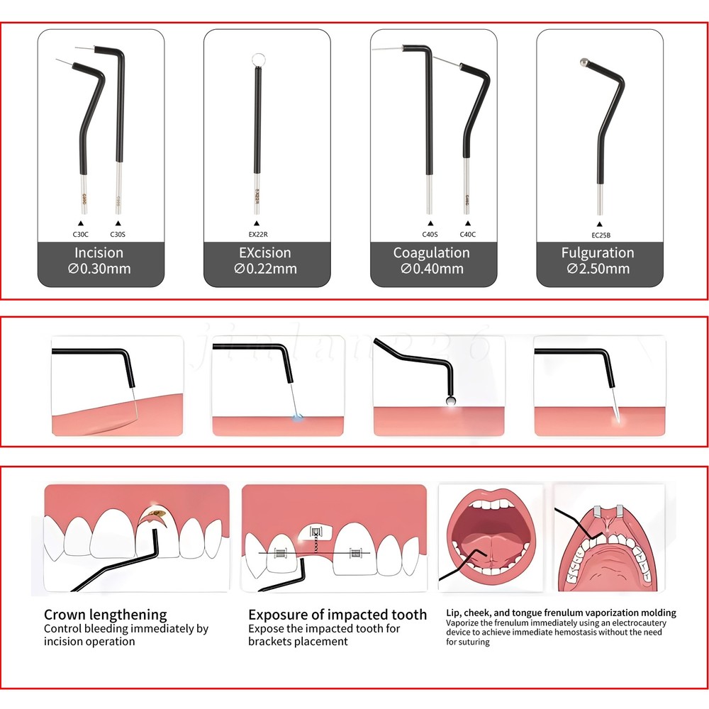 7-Piece Dental Electrodes Set with Reusable Tips (Black)