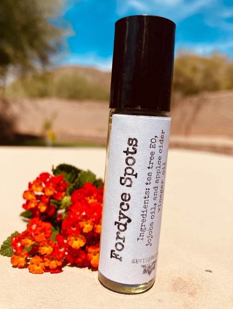 Fordyce Spots Essential Oil Roller 10 Ml