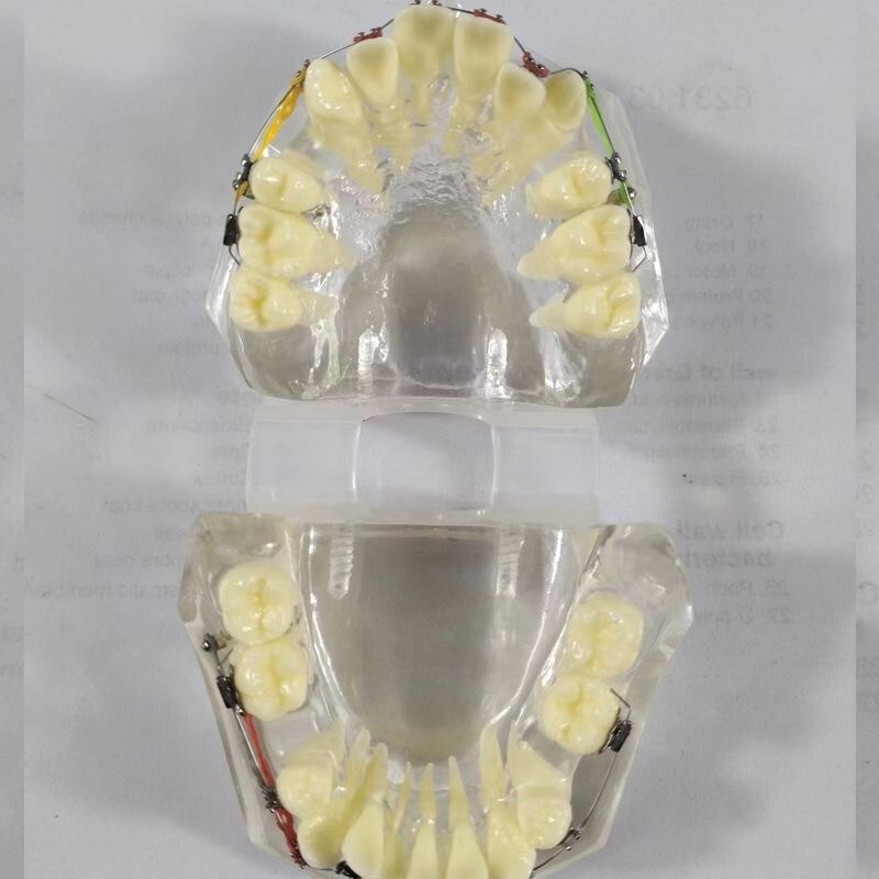 Dental Typodont Orthodontic Treatment Malocclusion Study Model w Brackets Chain