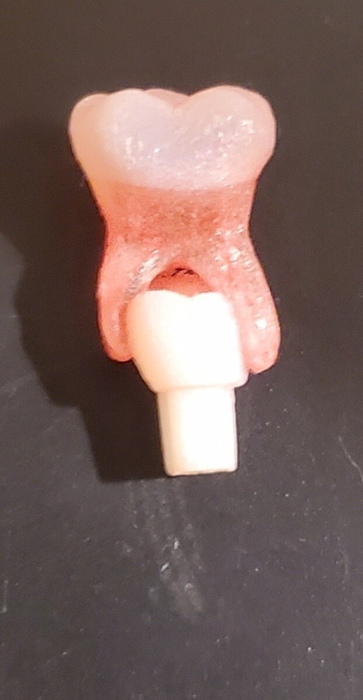 Acadental Endo 3DP Tooth #K