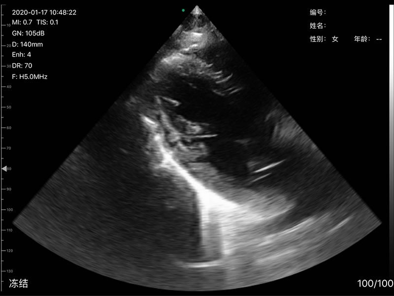 192 Elements convex/linear/phased array 3 in 1 Doppler Ultrasound Scanner