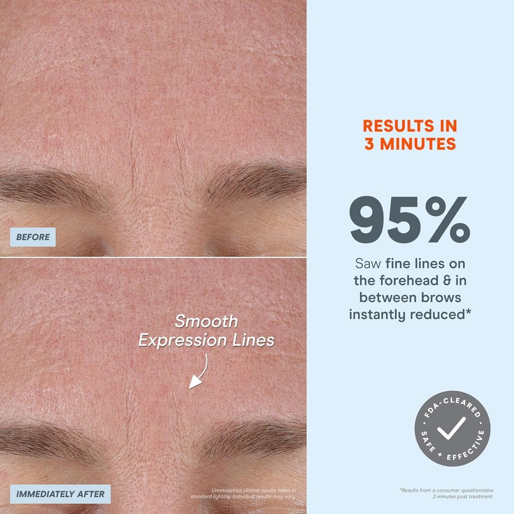 NuFACE FIX MicroWand Kit - Microcurrent Device for Eyes, Lips & Lines