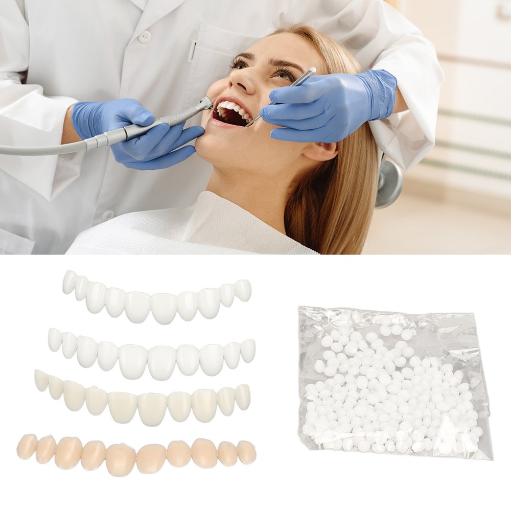 Temporary Tooth Repair Moldable False Teeth Thermal Fitting Beads for WT