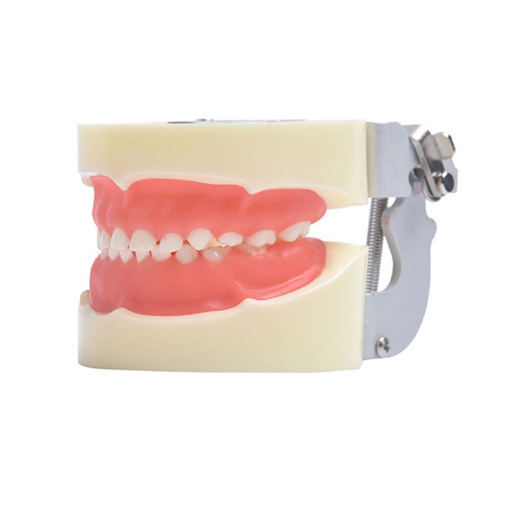 24 Teeth Removable Replaceable Children Deciduous Tooth Preparation Teacth Model
