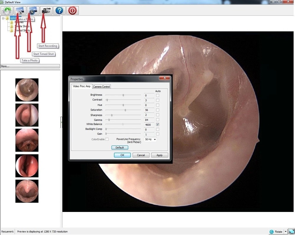 Rigid Endoscope Endoscopy Medical HD USB Camera+Coupler+LED Light Source+Mount