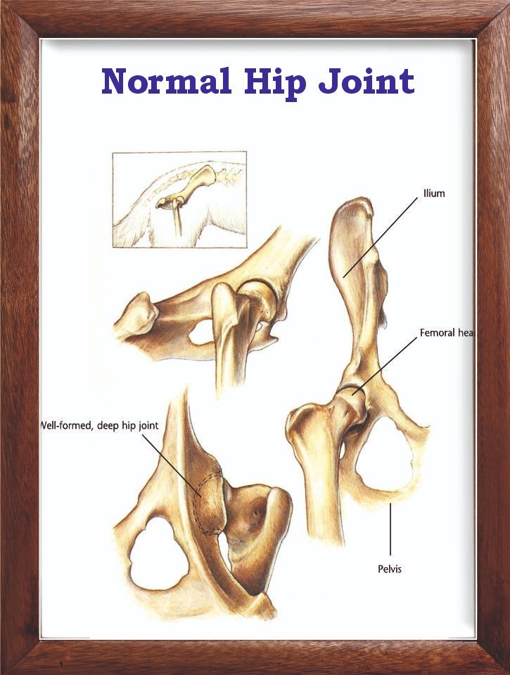 Normal Hip Joint Chart 12x18 inches