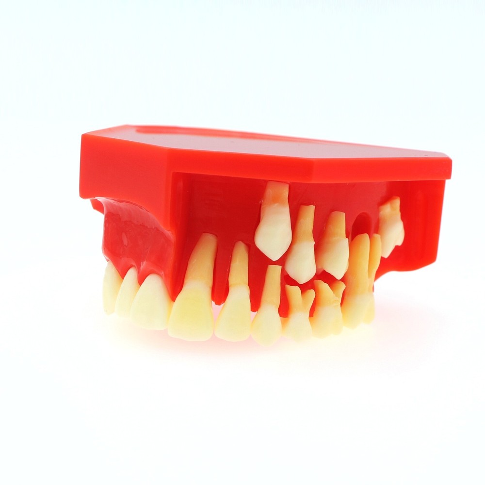 M7013 Teeth Permanent Tooth Dental Alternate Demonstration Study Teach Model