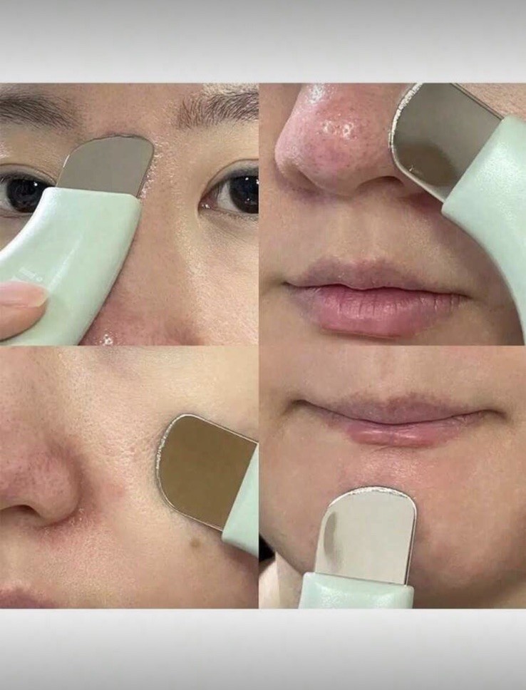2pc Manual Blackhead Remover, Blackhead Removal Tool, Blackhead Removal Scraper,