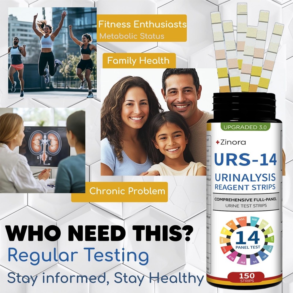 14-Parameters Urine Reagent Strips [150ct], Comprehensive Urinalysis Detectio...