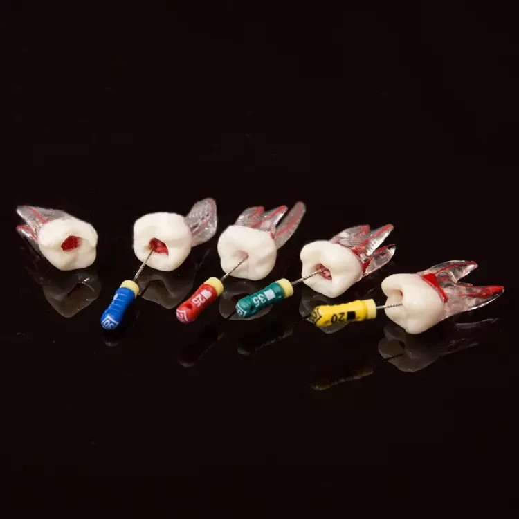 5Pcs Dental Tooth Endo Root Canal Study Model For RCT Practice Block Pulp Cavity