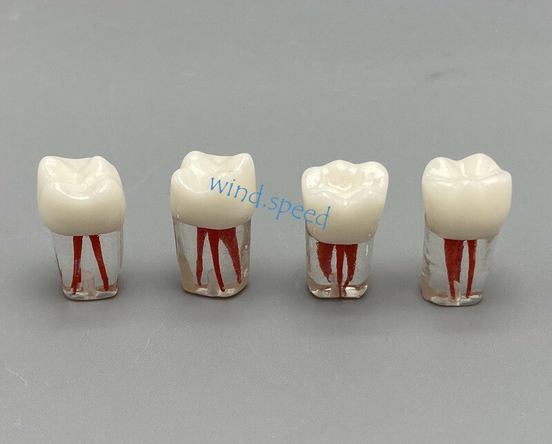100pc Dental Root Canal Teeth Study Practice Model Endodontic RCT Endo Pulp File
