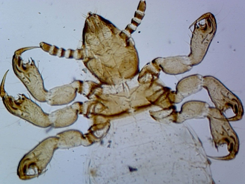 Pediculus Humanus Capitis, Female; Whole-mount