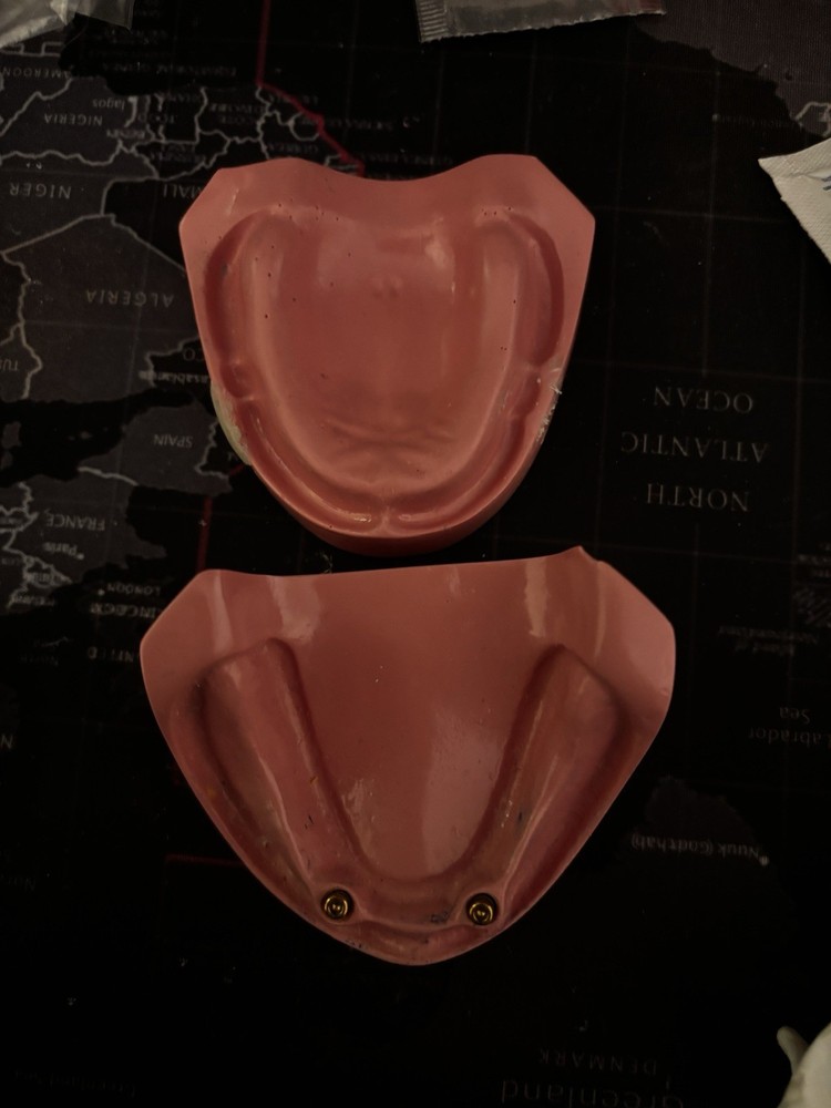 acadent edentulous Typodnont Acadent