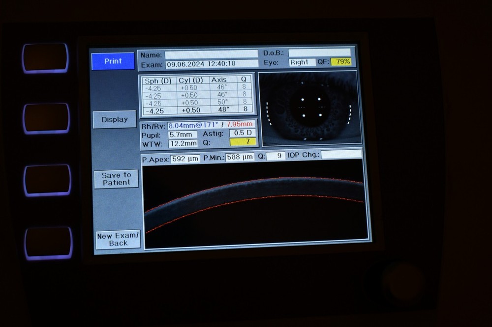 Oculus PARK 1 Autorefractor Keratometer pachymetry