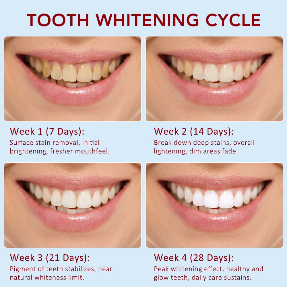 SP-6 Probiotic Toothpaste,Sp-6 Toothpaste Ultra Whitening Quick White Toothpaste