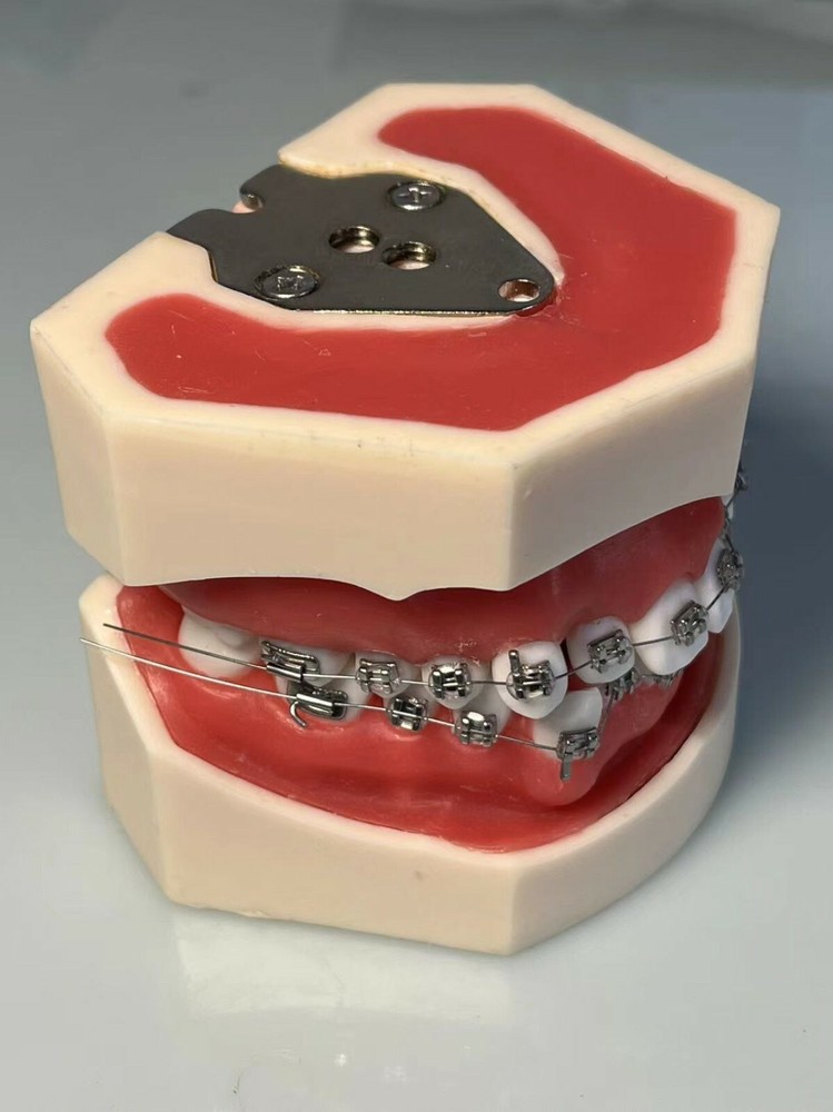 Dental Typodont Orthodontics Model Wax Teeth Training (apply To Head Model)
