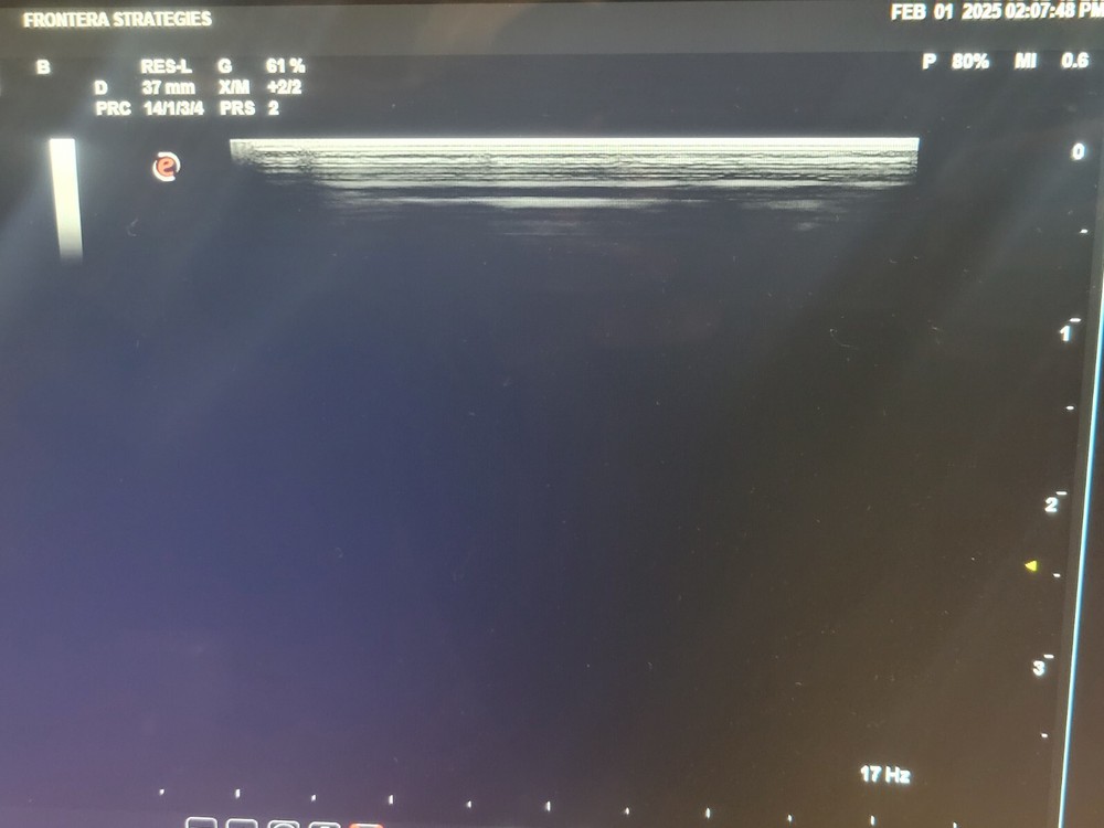 Esaote AL 2442 Linear Array Ultrasound Transducer