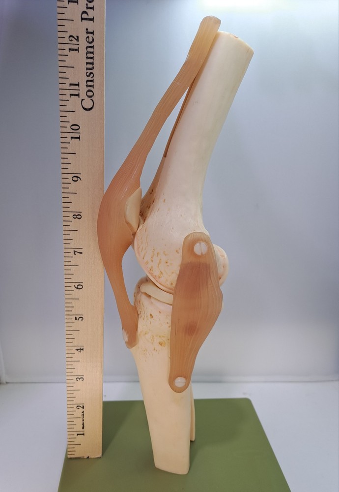 Vintage 1995 Somso Anatomical Model Functional Knee Joint Model BIN86
