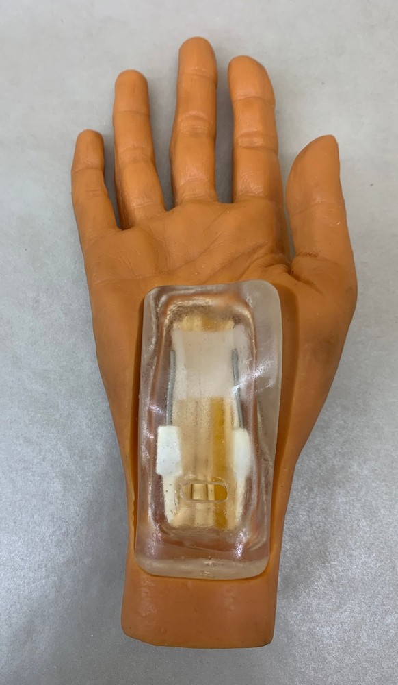 MicroAire 81014 SmartRelease Carpal Tunnel System w/ Hands, Endoscope & More