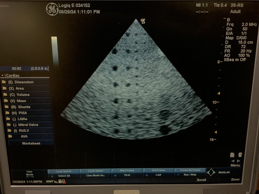 2005 GE 3S-RS Phased Array Ultrasound Probe (White Connector)