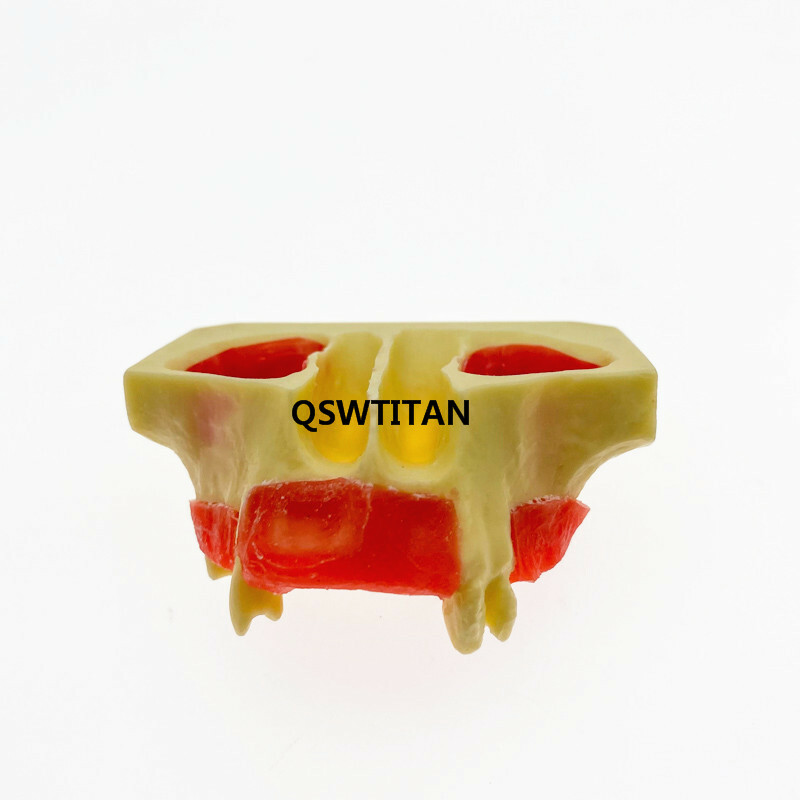Dental Sinus Lift Practice Teeth Model Typodont Study Tooth Model M2012