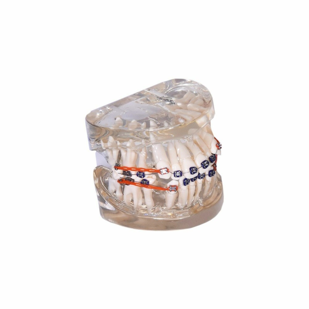 Redland B2-01 Dental Demonstration Teeth Educational Model
