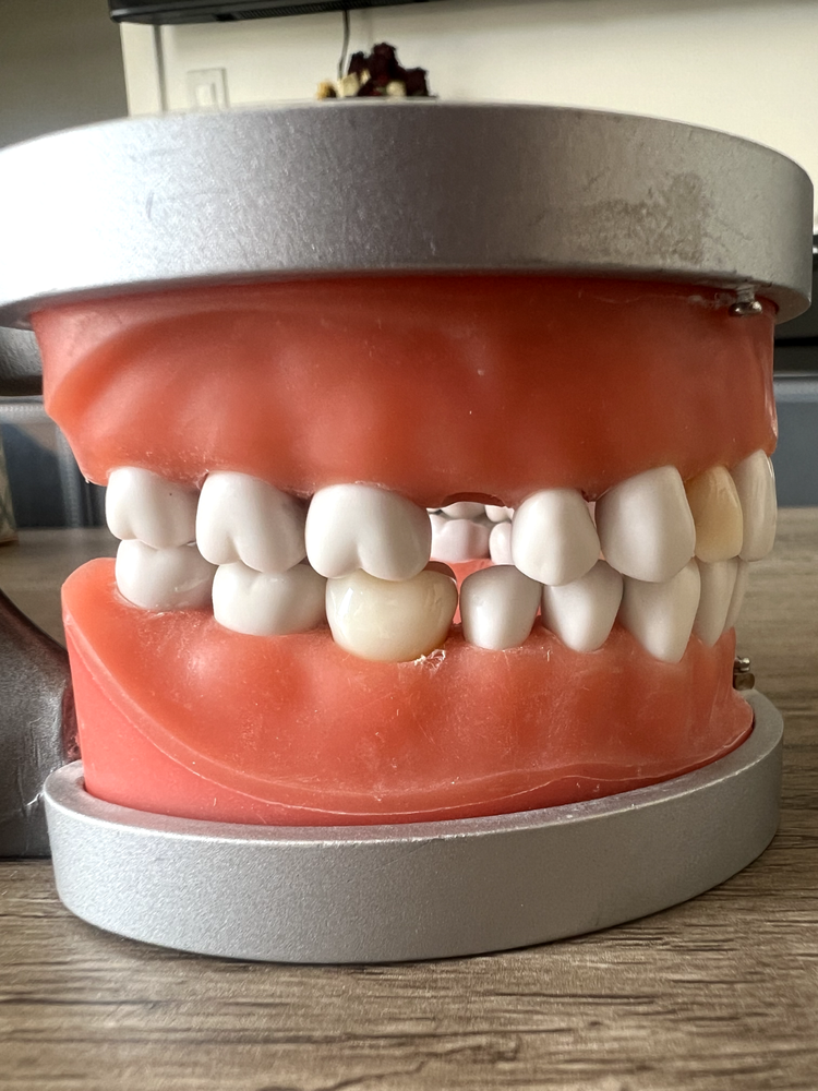 Acadental ModuPRO Restoration Typodont + Case WREB CDCA ADEX
