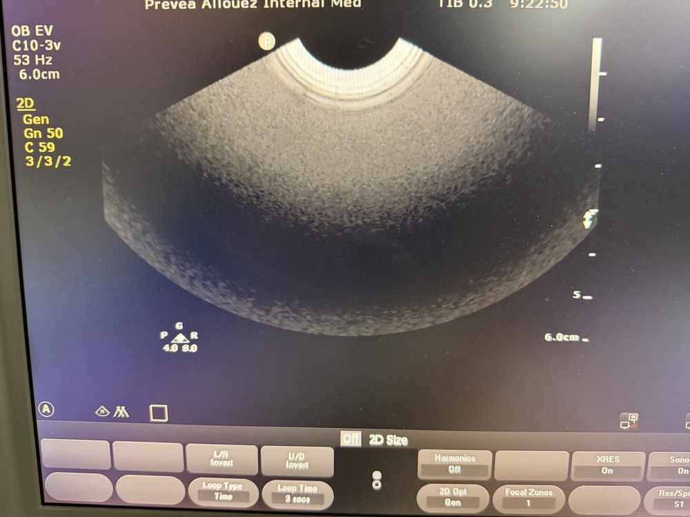 PHILIPS C10-3V CURVED ARRAY ENDOCAVITY TRANSDUCER PROBE, TESTED