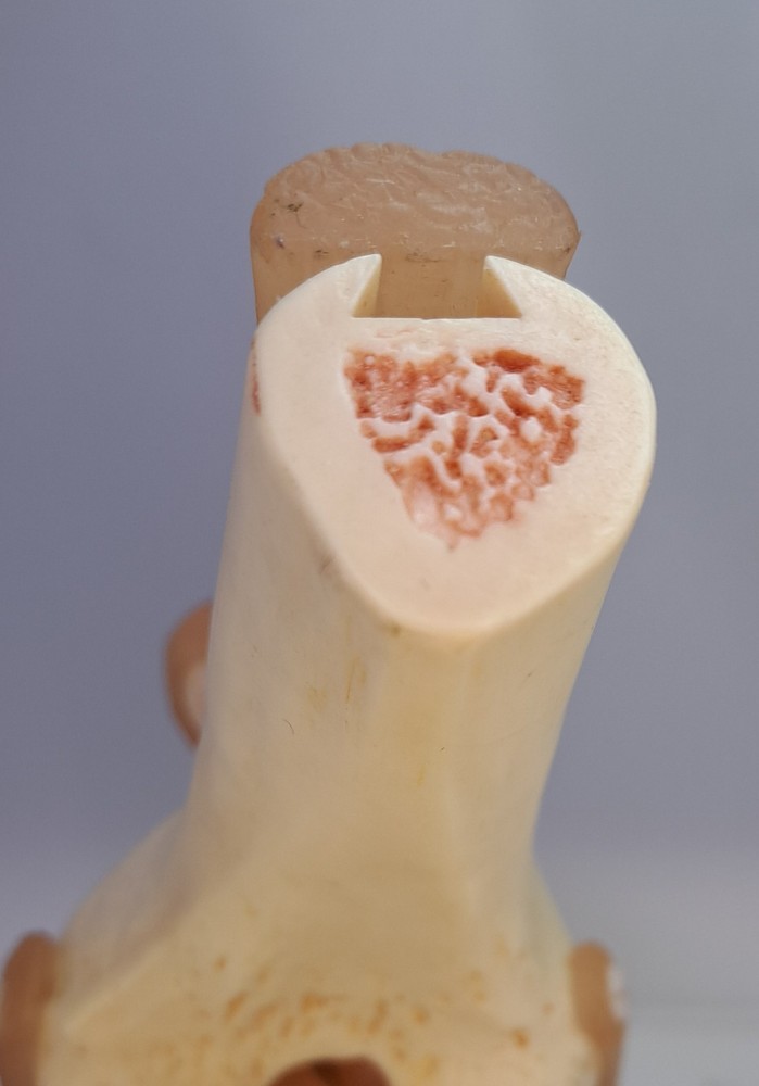 Vintage 1995 Somso Anatomical Model Functional Knee Joint Model BIN86