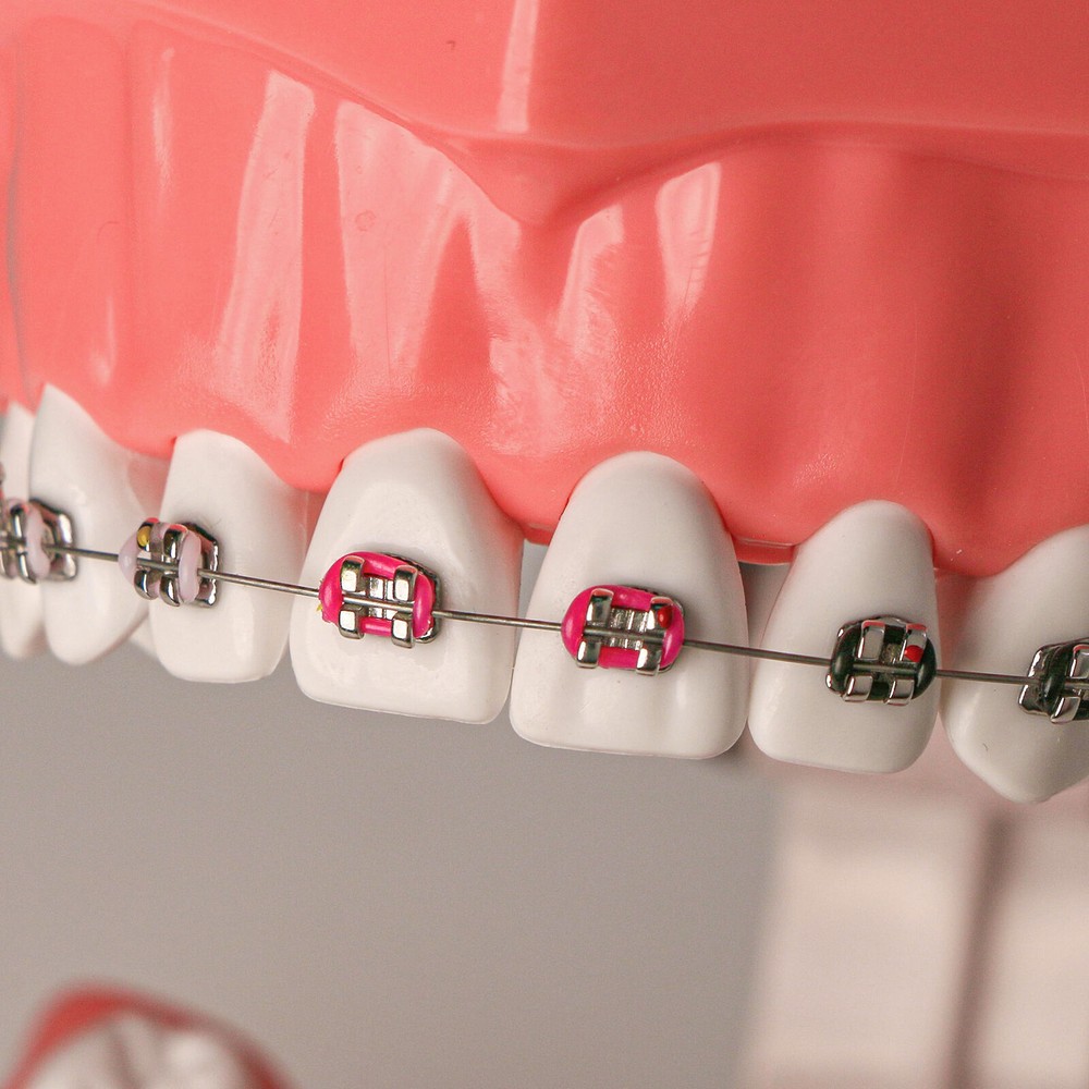 Dental 1:1 Orth Typodont Teeth Model with Brackets Brushing Flossing Practice