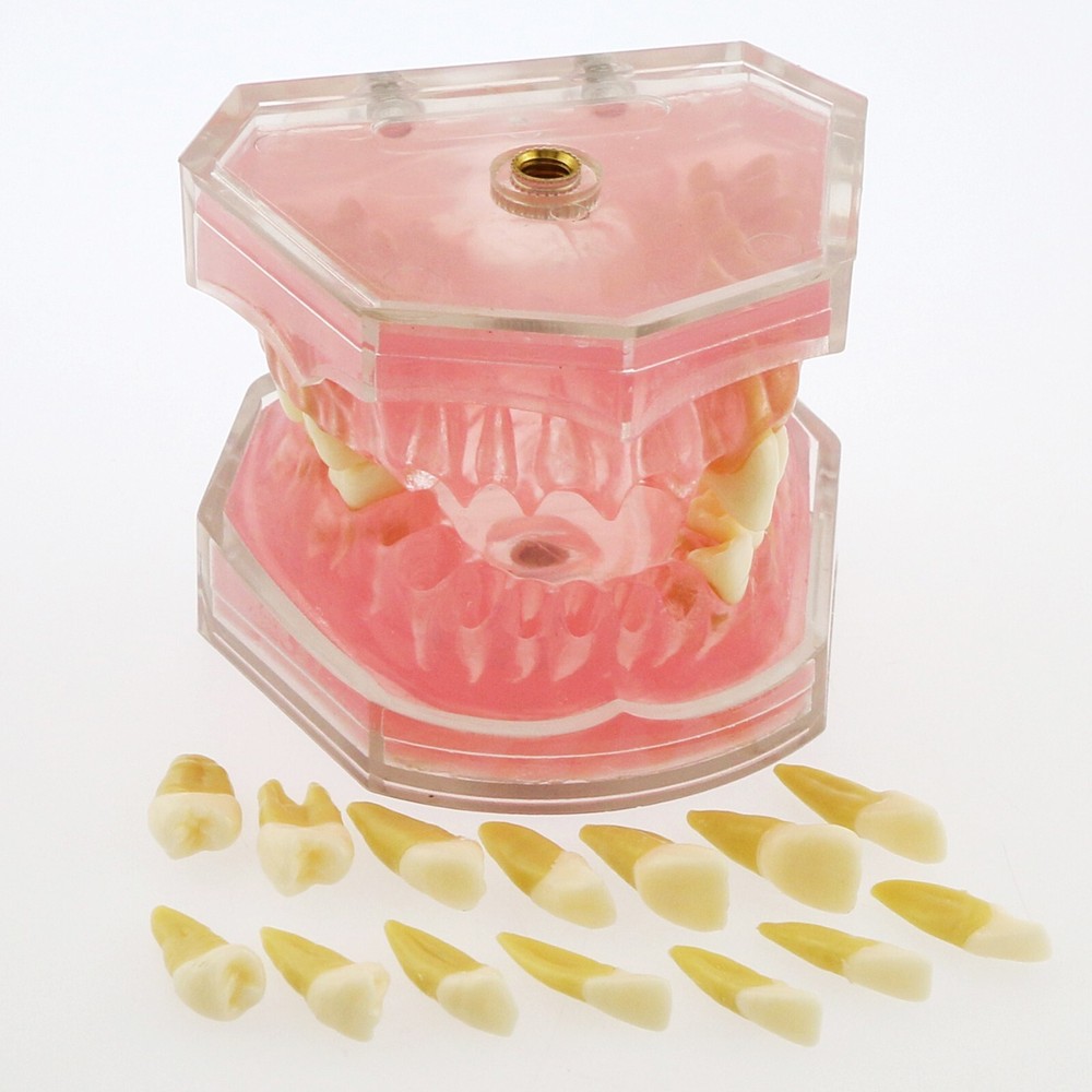 Dental Typodont Practice Study Standard Teeth Model Soft Gum Simulation Cheek