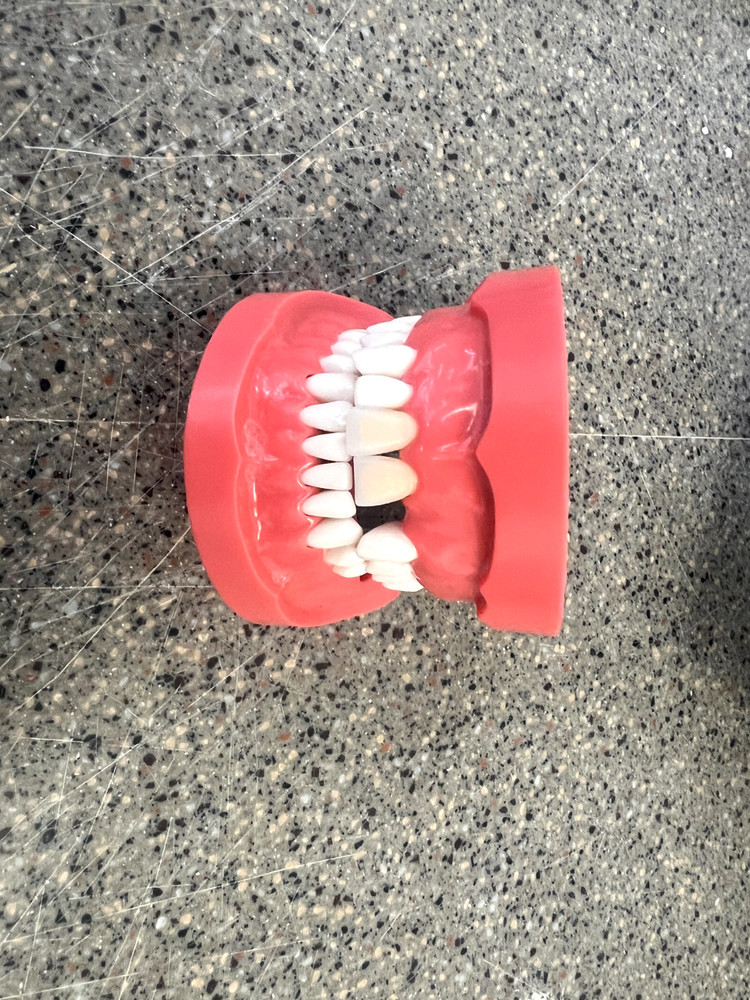 Kilgore MCG-1 Fixed Dentoform (Nissin Dental Model)