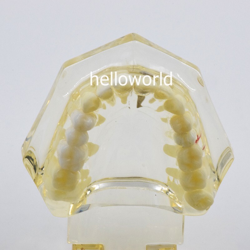 Dental Teeth Model Teach Study Oral Implant Restoration & Pathology Bridge