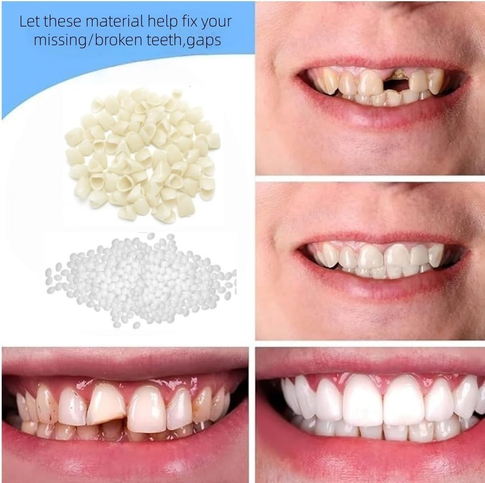Temporary Teeth Crown Kit with Fitting Beads for Missing, Broken Teeth, Gaps, De