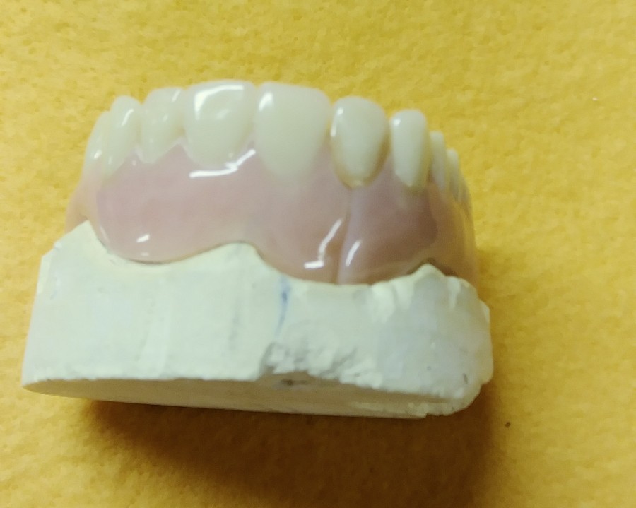 Devided Denture DENTAL DEMONSTRATION TEACHING MODEL Lab Dentist & Oral Surgeon
