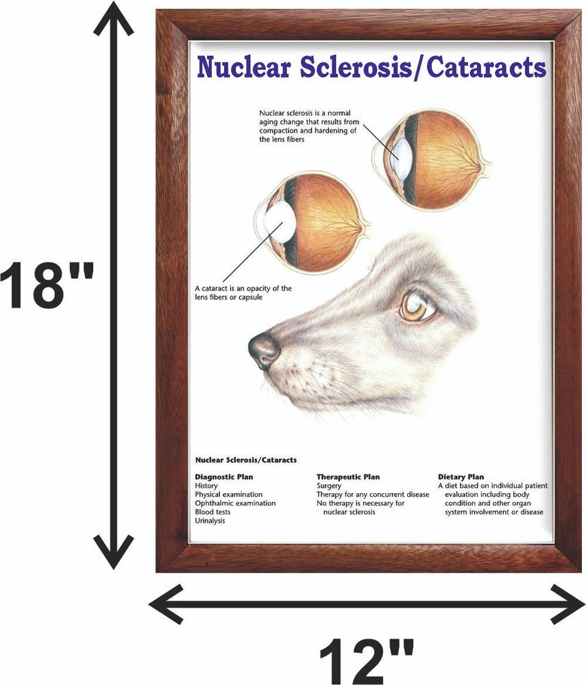 Nuclear Sclerosis/Cataracts Chart 12x18 inches