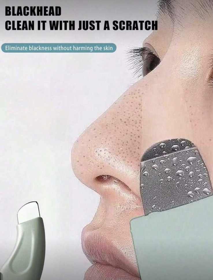 2pc Manual Blackhead Remover, Blackhead Removal Tool, Blackhead Removal Scraper,