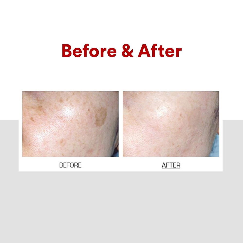 MEDIPEEL Melanon X CREAM 30ml