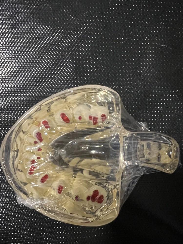 Dental Pathology Demonstration Study Tooth Teeth Model