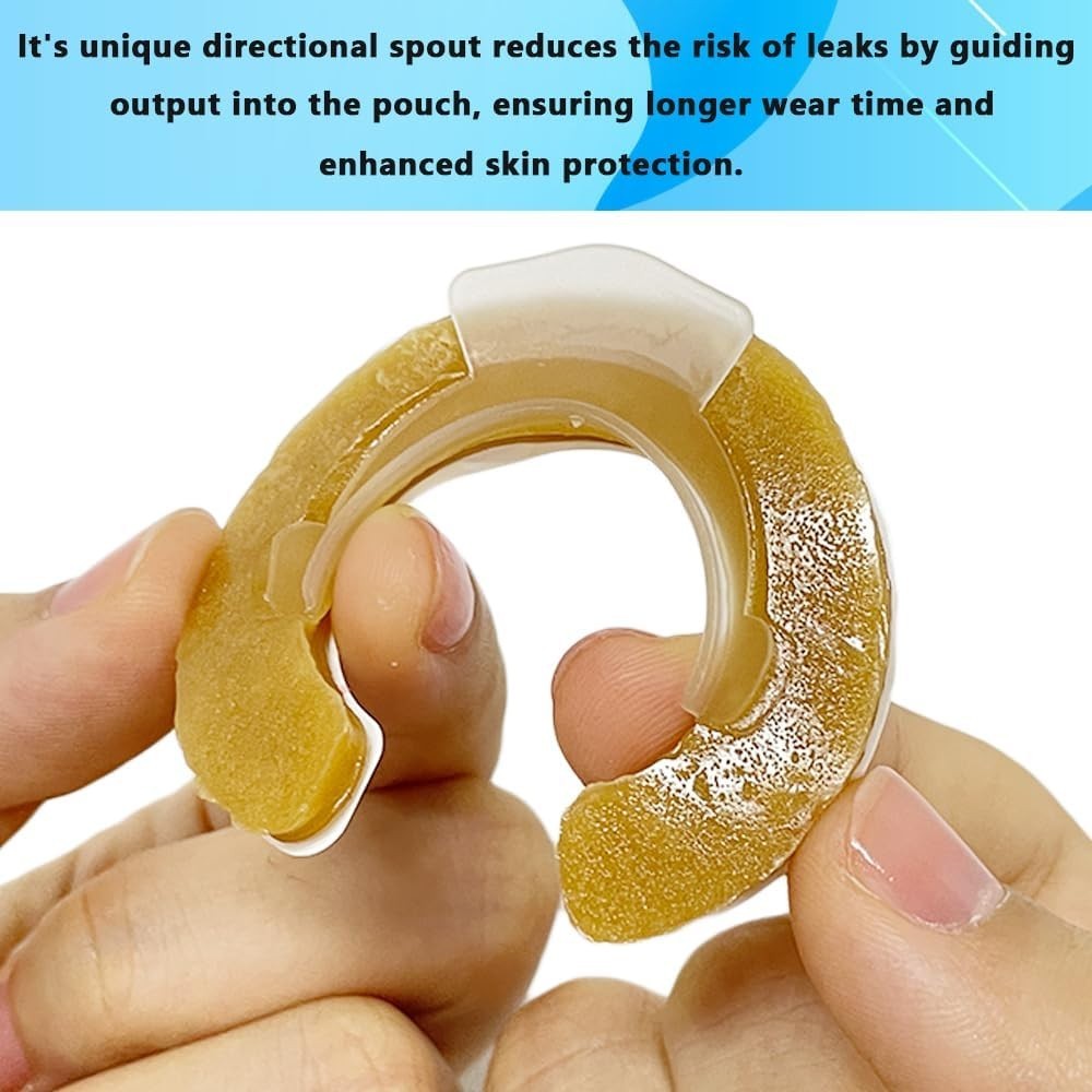 Ostomy Barrier Rings Moldable & Leakproof Directional Spout 2–4" Adjustable 10pc