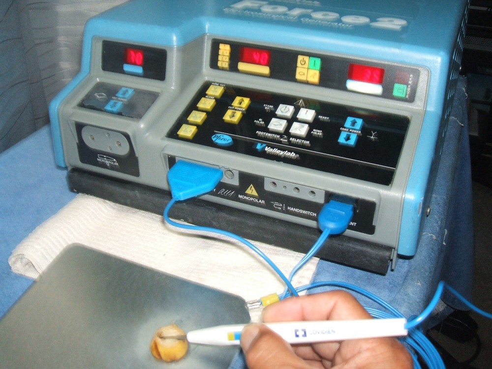 Valleylab Force 2 ESU, Pt. Ready, Nice/Clean/In Great Working Condition, Cert'd