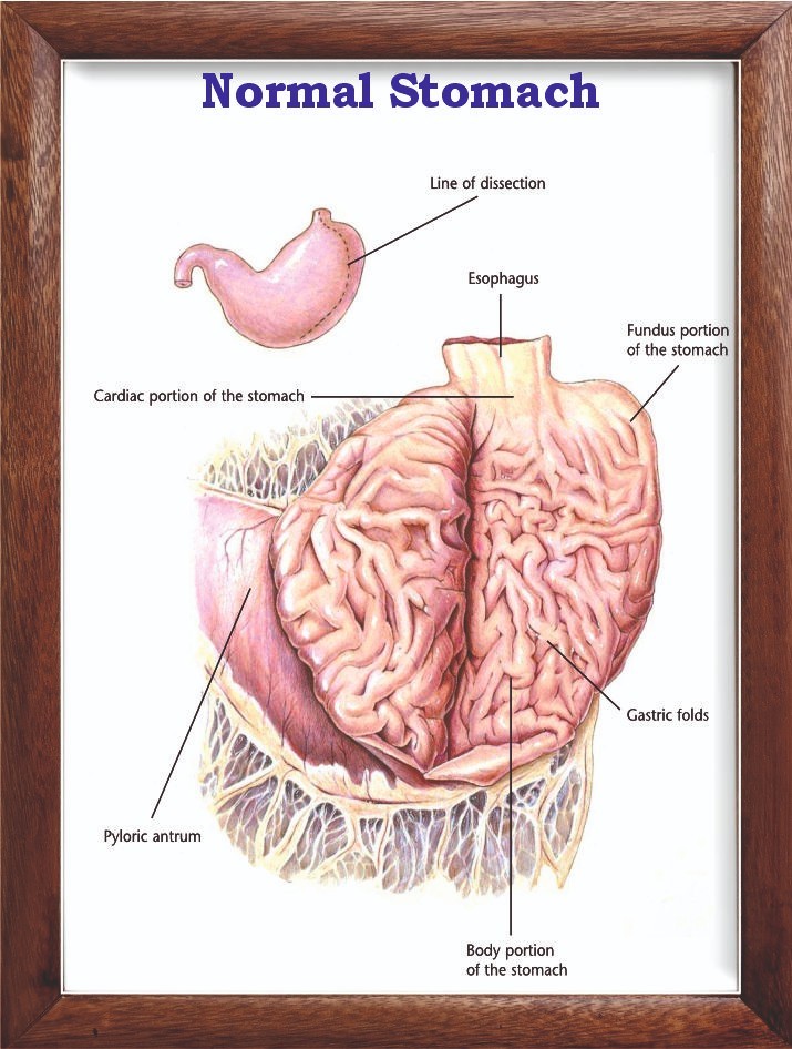 Normal Stomach Chart 12x18 inches