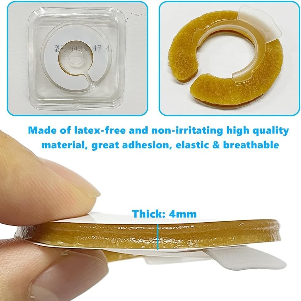 Ostomy Barrier Rings Moldable & Leakproof Directional Spout 2–4" Adjustable 10pc