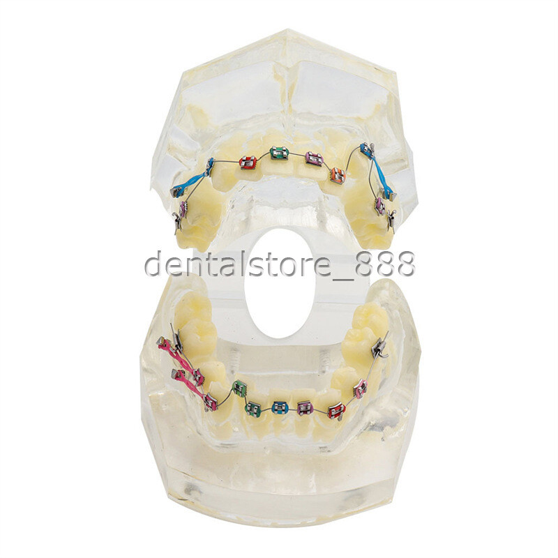 Dental Typodont Orthodontic Treatment Teeth Model Malocclusion Study w/ Bracket