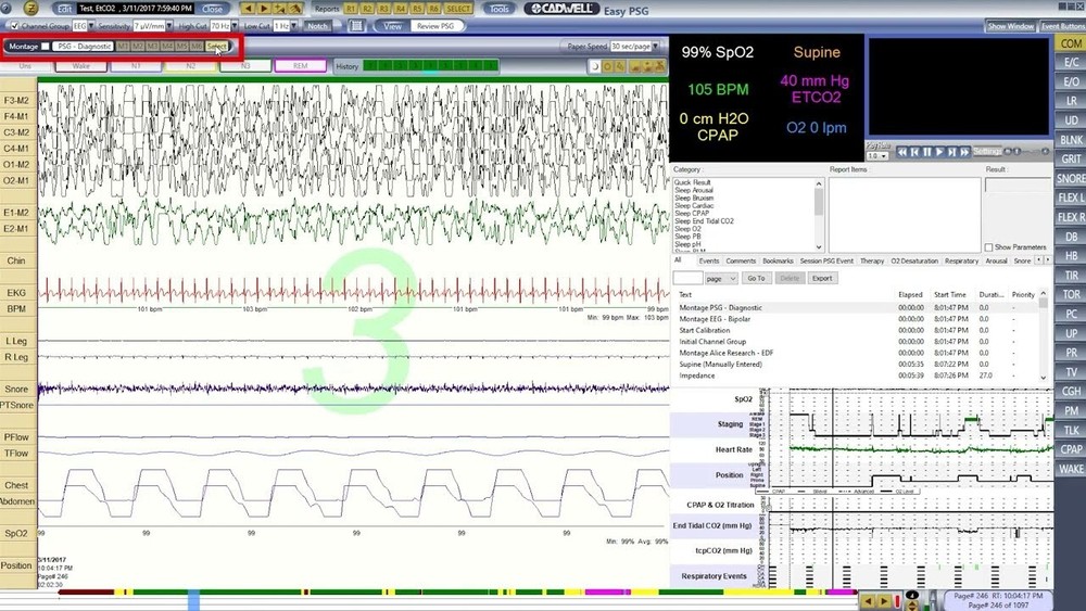 Cadwell Easy III Software version 4.1. SP1 (Software + Installation)