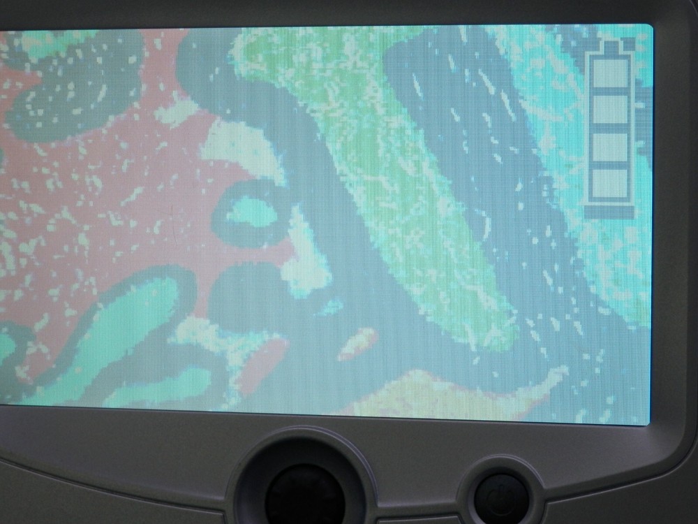 Ash Technologies Fusion Portable Low Vision Magnifier System Viewing Aid w/ Case