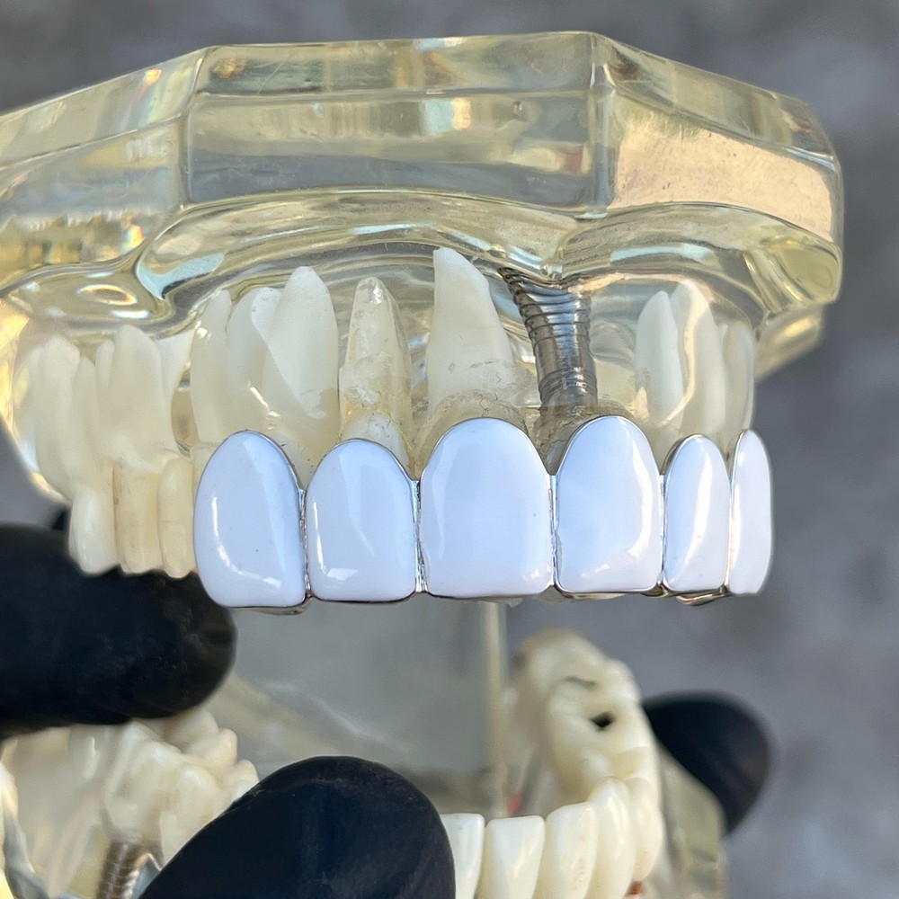Real Solid 925 Sterling Silver White Enamel Grillz Rapper Grill Six Top Teeth